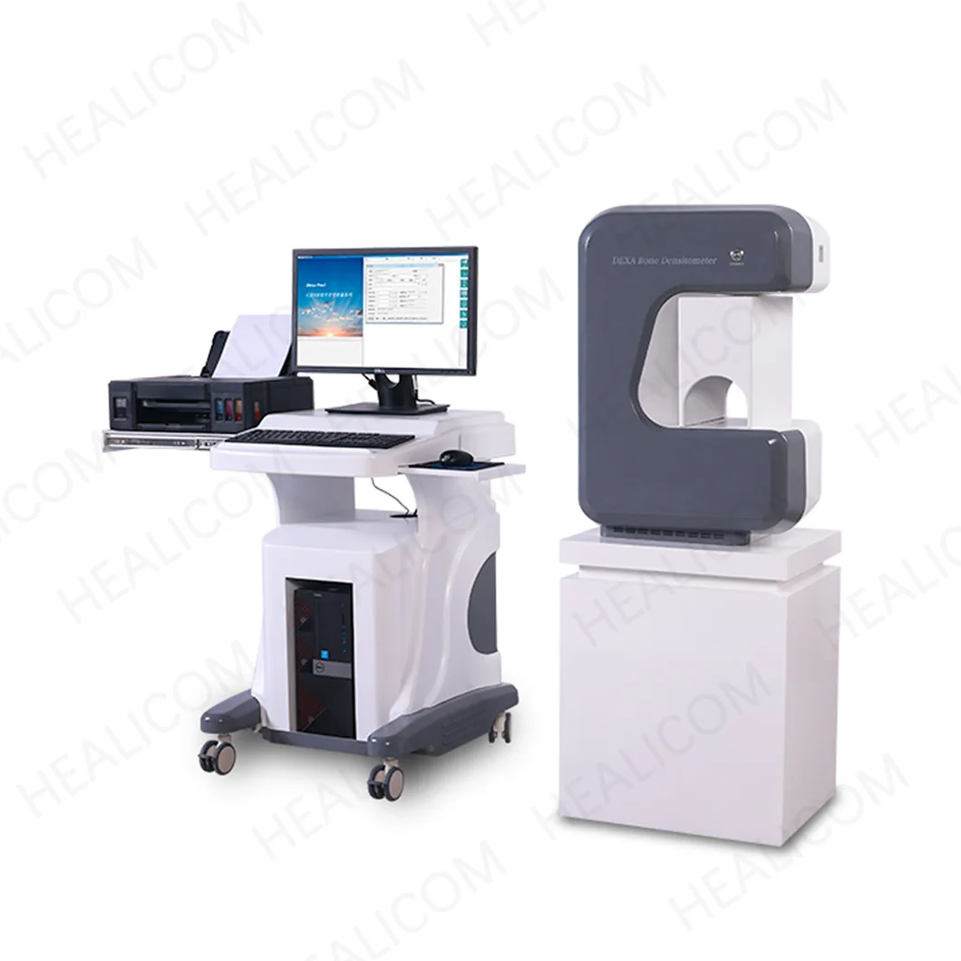 Bone Densitometry Equipment X Ray Bone Densitometer Preventing Osteoporosis Dual Energy DEXA Absorptiometry