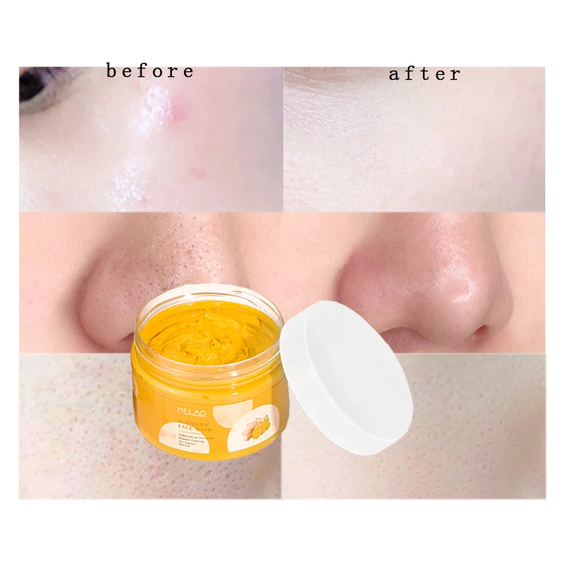 Куркума Порошковая глиняная маска для лица корейский уход за кожей куркума маска для лица осветляющая тусклая кожа Имбирная грязевая маска для лица