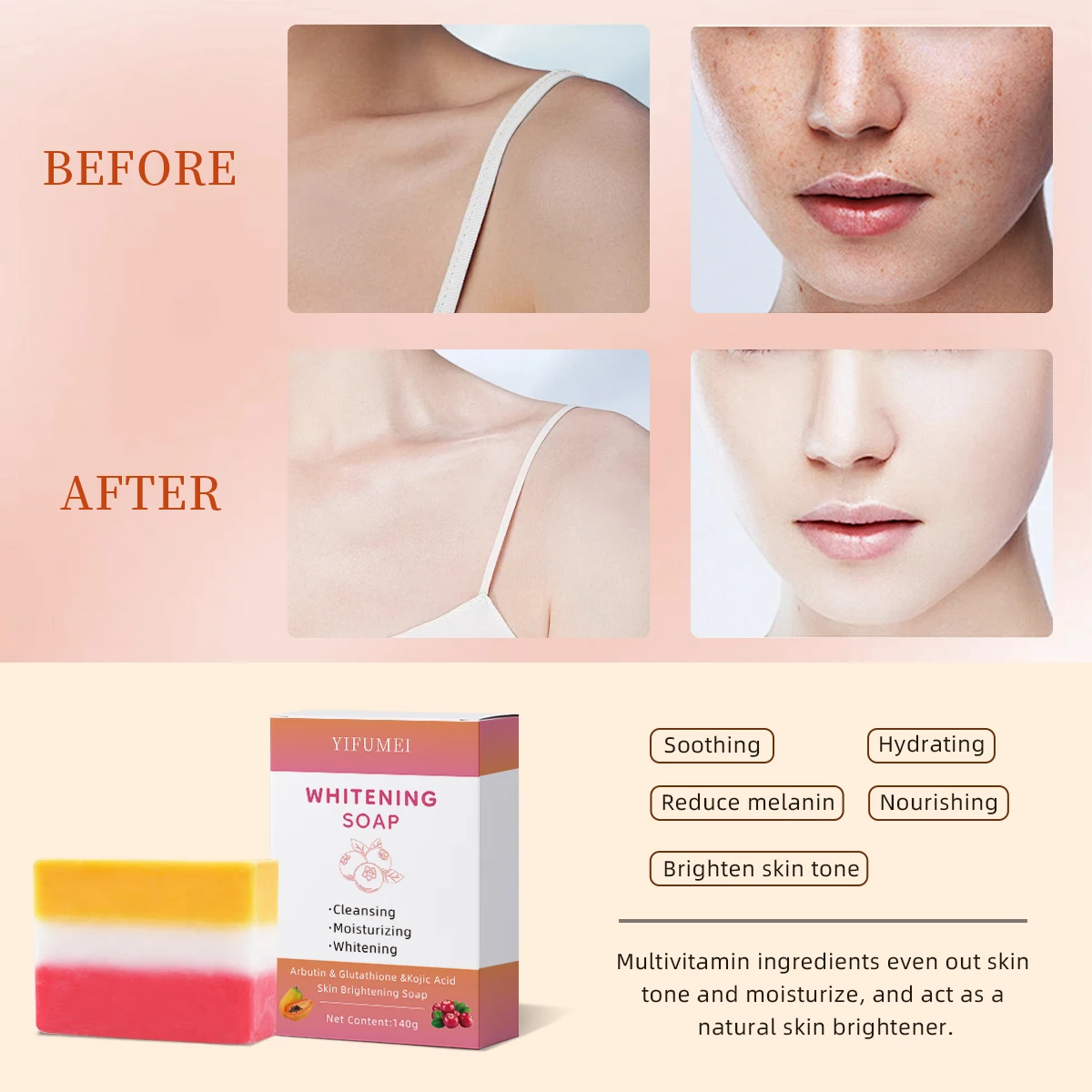 Private Label Handmade Niacinamide Whitening Glowing Acne Natural Kojic  Acid Arbutin Best Soap for Face