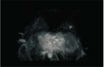 Hospital Medical Magnetic Resonance Imaging System 1.5T  MRI Machine with A-combi and Al Technologies factory