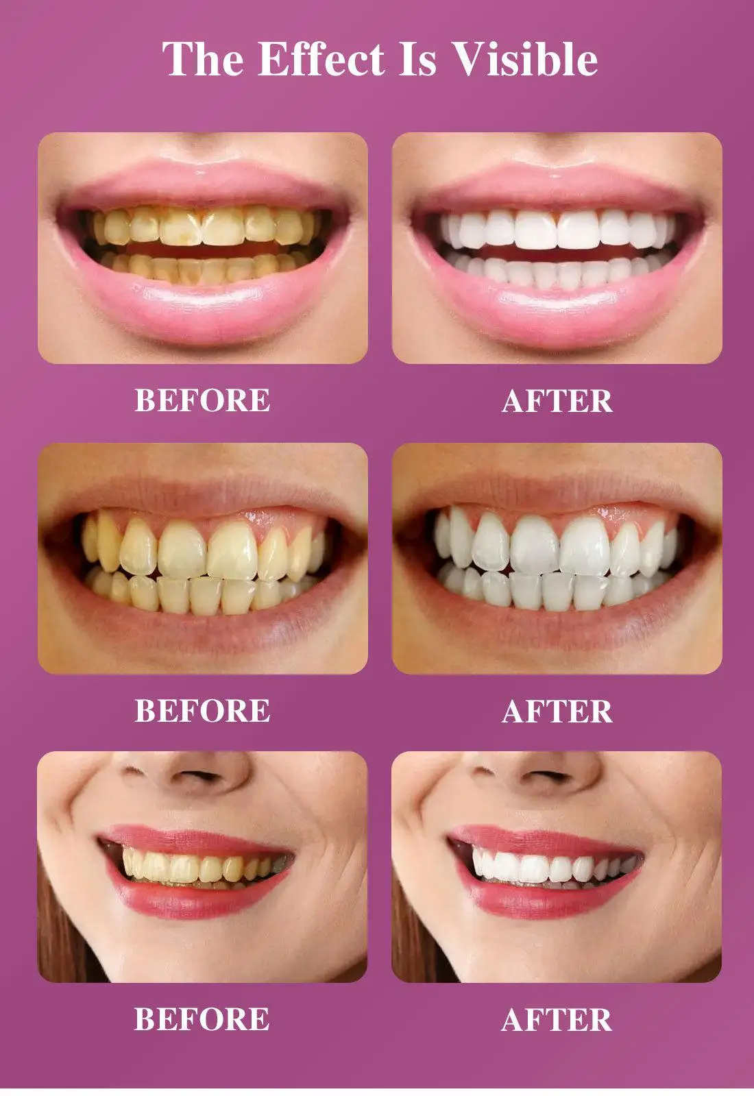 Rtopr 10ml Mint Tooth Whitening Brightening Essence Plaque Stains