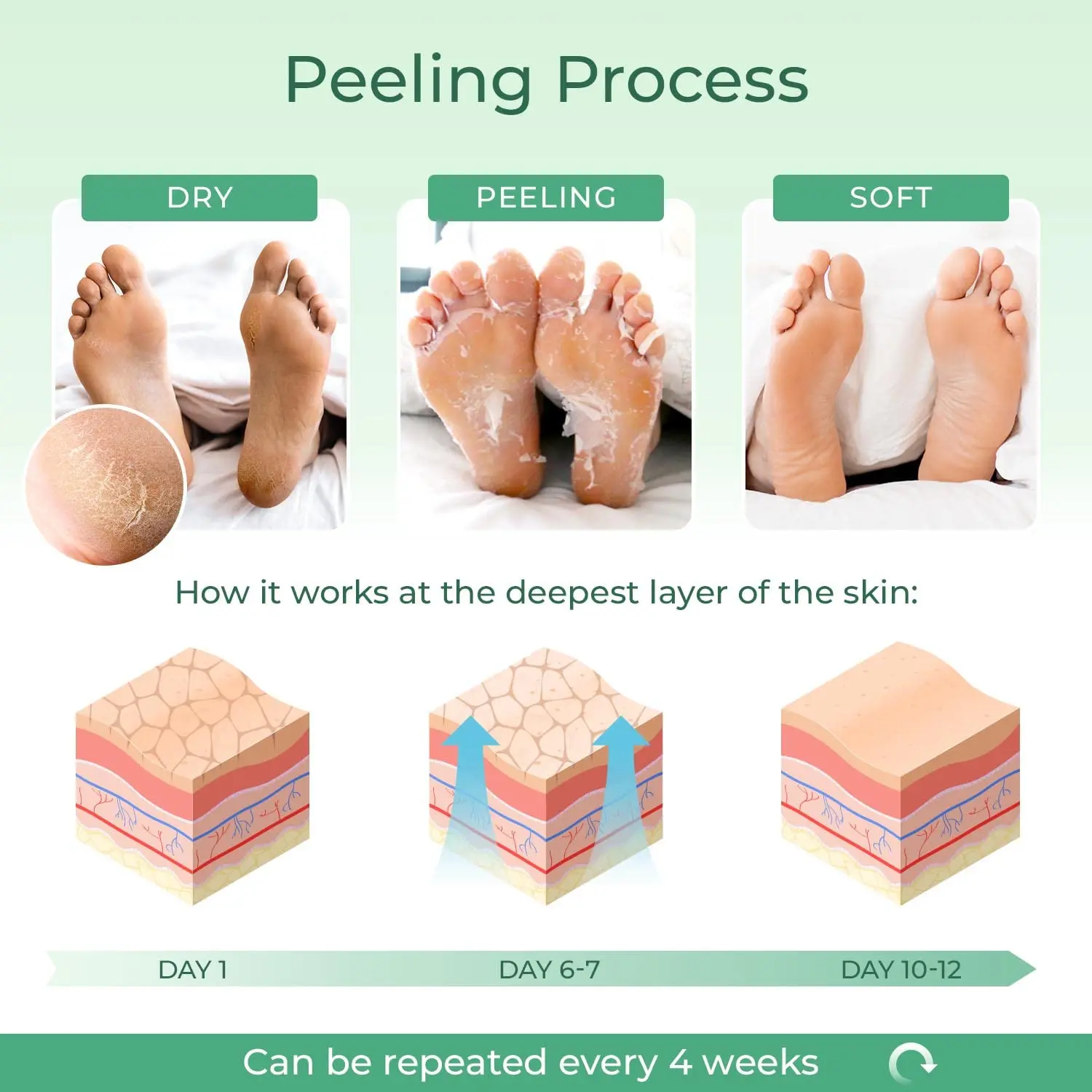 Professional Foot Care Dead Skin Remover – Mavigadget