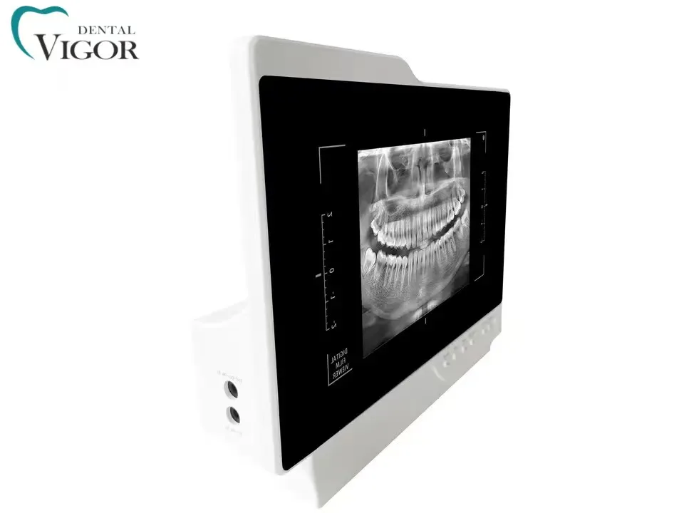 Digital Intraoral Endoscopy Camera With Monitor for Dental Chair Dental Inter Oral Endoscopy