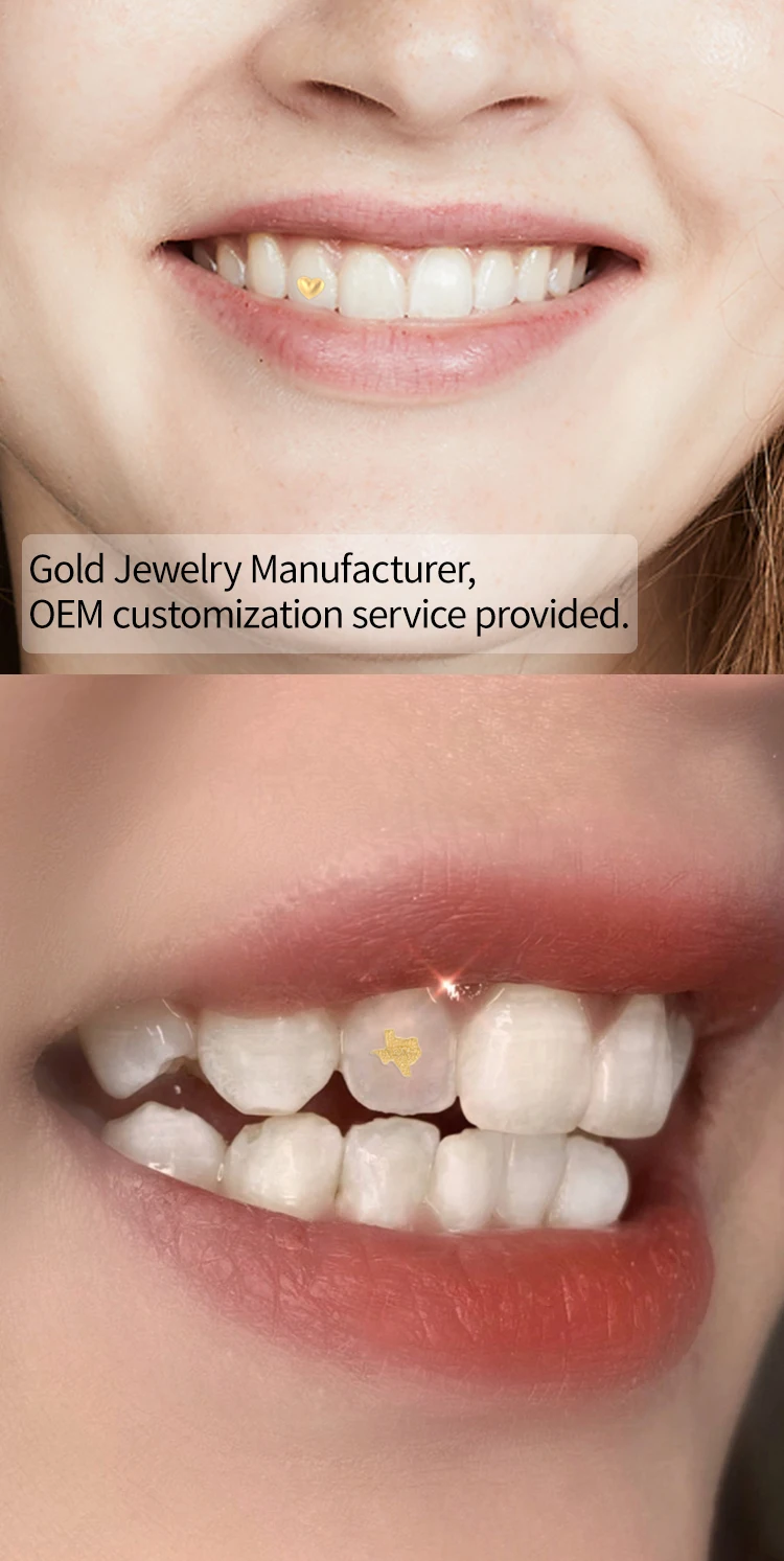 Custom Dental Jewelry Teeth Gems Etching Real Solid 14k 18k 22k Gold