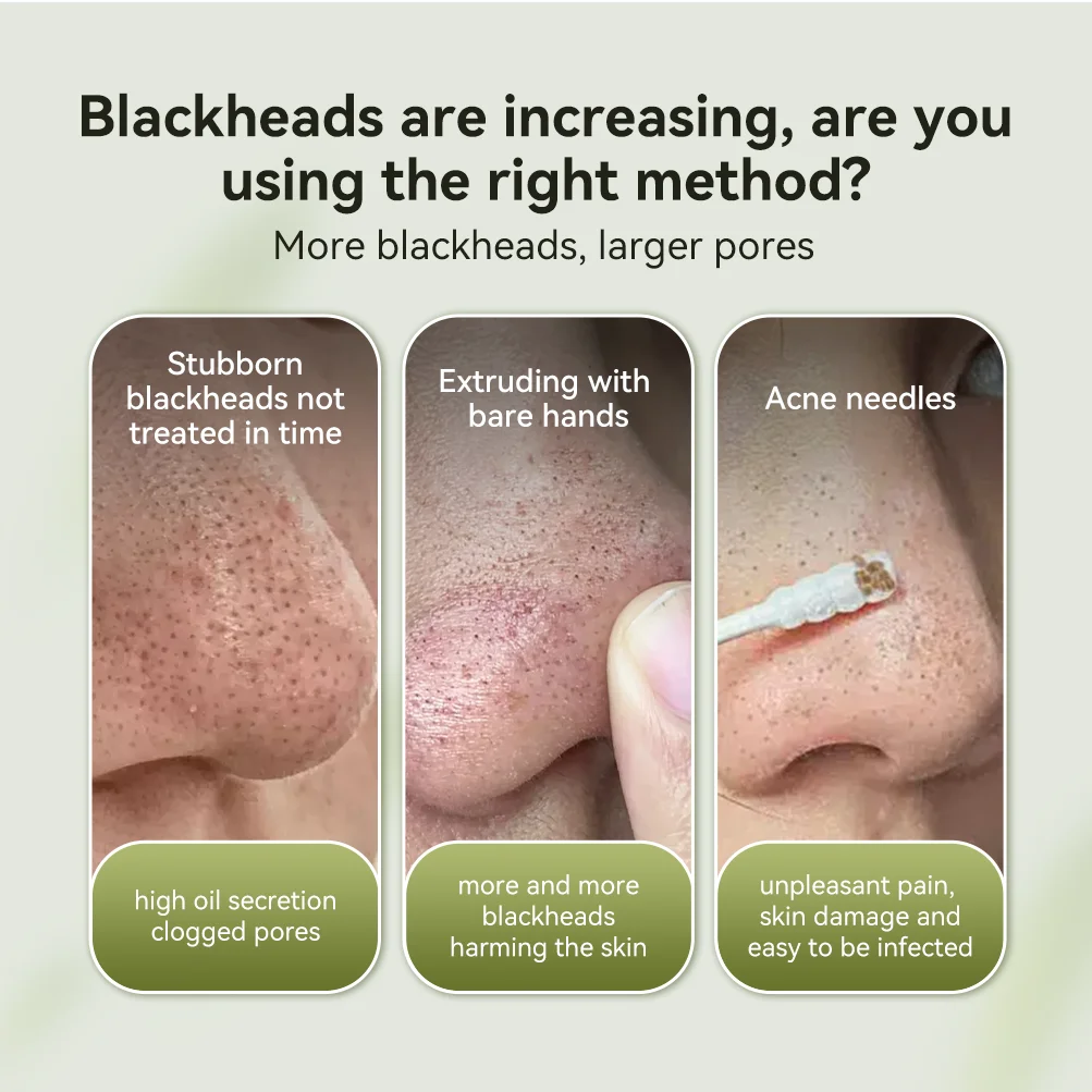 Lanbena Hot Sales Clean Black Head Remove Organic Nose Mask Acne Nose Mask Remove Strips Pore Strip factory