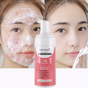 Private Label Korean Organic Cleansing Mousse Bha Salicylic Acid Acne ...