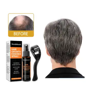 West&Month OEM Hair Growth Spray Serum Natural Anti Hair Loss Products Fast Growing Prevent Baldness Treatment Germinal Liquid