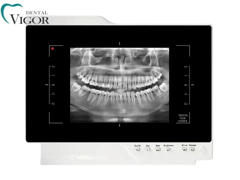 Digital Intraoral Endoscopy Camera With Monitor for Dental Chair Dental Inter Oral Endoscopy
