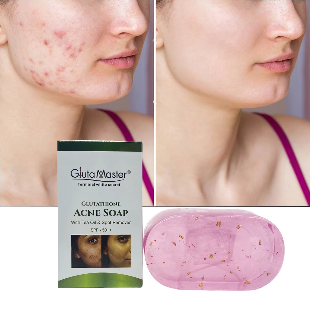 Gluta Master Glutathione Acne Pimples Soap