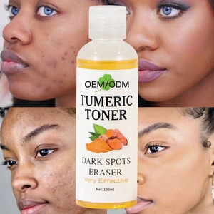 Custom 100ml Organic Turmeric Witch Hazel Ginseng Face Toner Hydrating Moisturizing Anti-Acne Whitening Lightening Oil Control