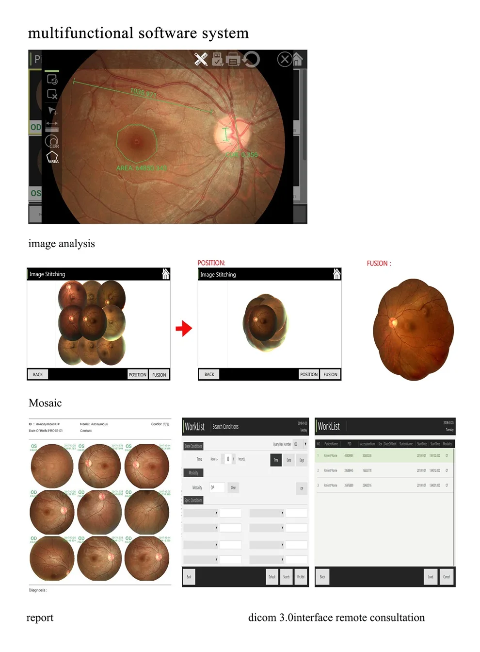 High-definition Ophthalmic Instrument Automatic Fundus Camera Reticam 3100 Optical Device High-definition Imaging