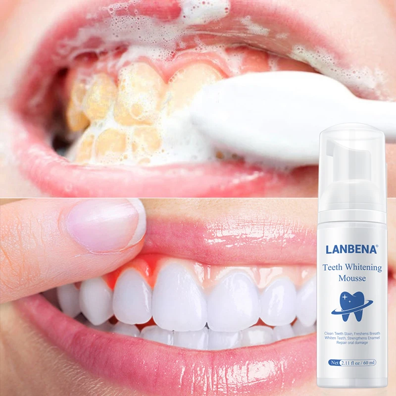 LANBENA teeth cleanser mousse teeth whitening foam wash