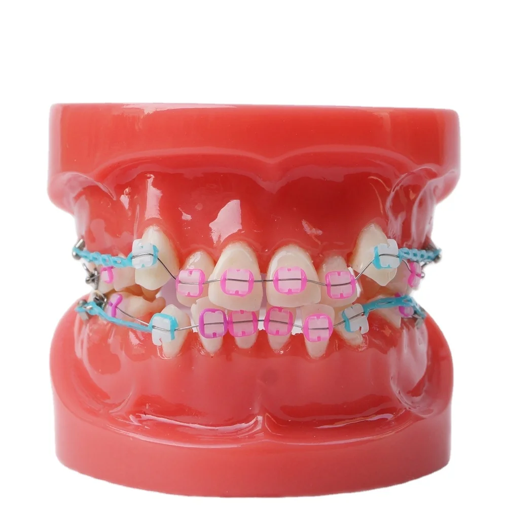Dental Comparison Model Full Ceramic Bracket Model Teaching