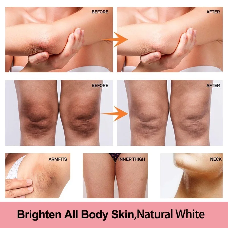 Advanced Bleaching Whitening Vitamin C Body Cream Face and Body Whitening Cream Brightening Cream