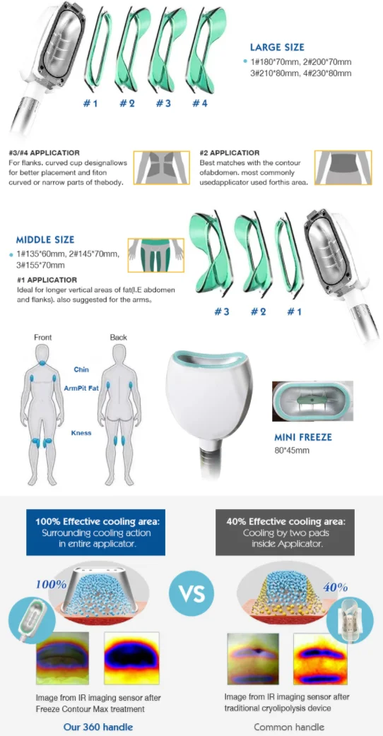 green 360 degree cryolipolisis machine cryotherapy slimming machine
