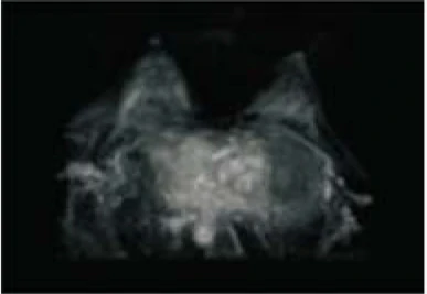 Hospital Medical Magnetic Resonance Imaging System 1.5T  MRI Machine with A-combi and Al Technologies details