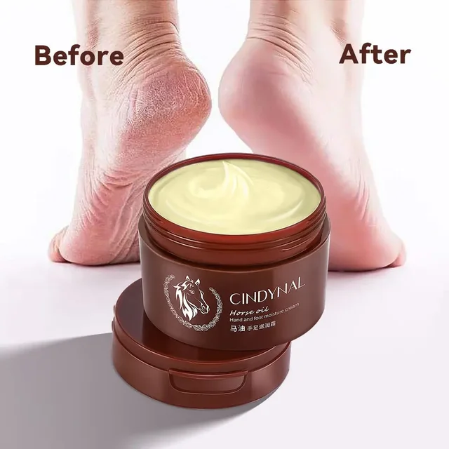 Repairing Foot Cream Wholesale Dry Skin Moisturize Foot Softening Cream Callus Customize For Antifungal Foot Cream