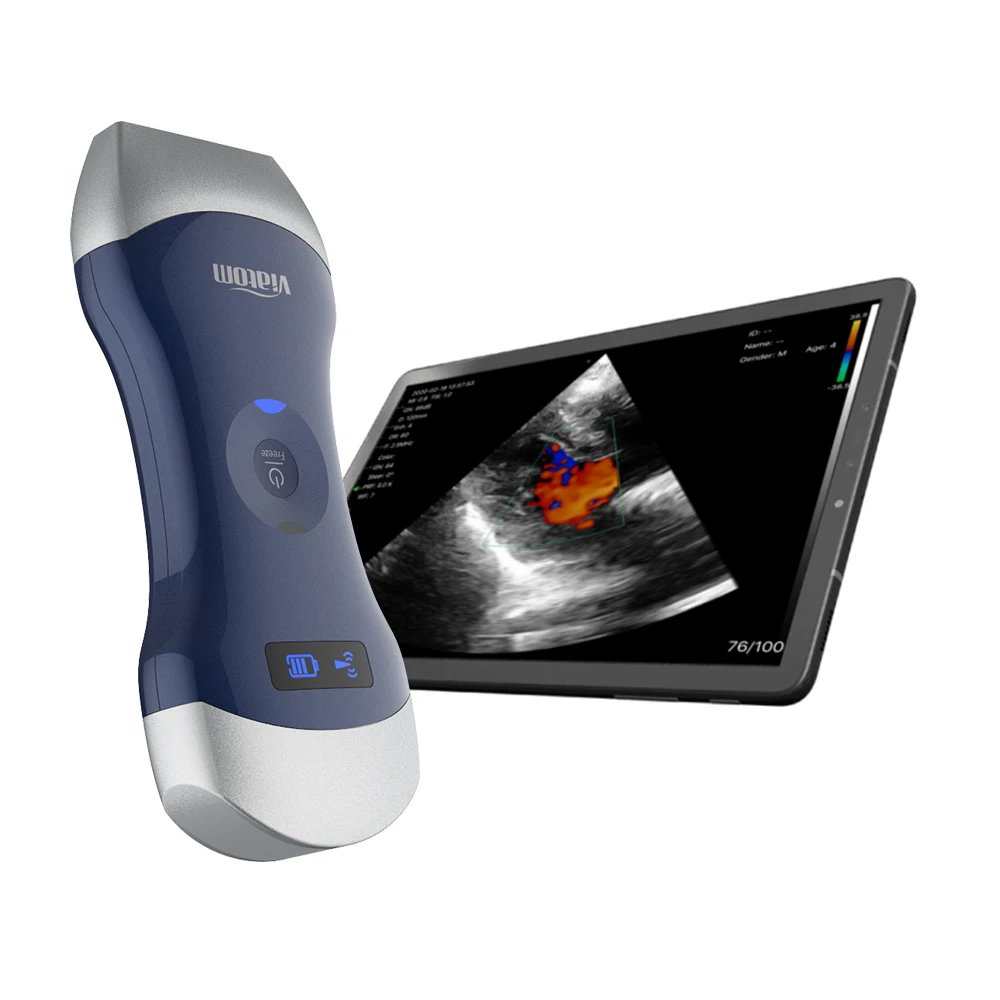Viatom Wireless Physiotherapy Machine Probe Handheld Scanners