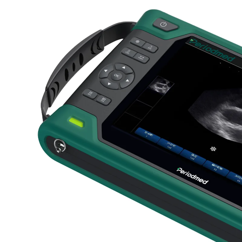 Yonker Factory Price Veterinary Ultrasound Machine Veterinary Ultrasound Portable Xuzhou Veterinary Ultrasound