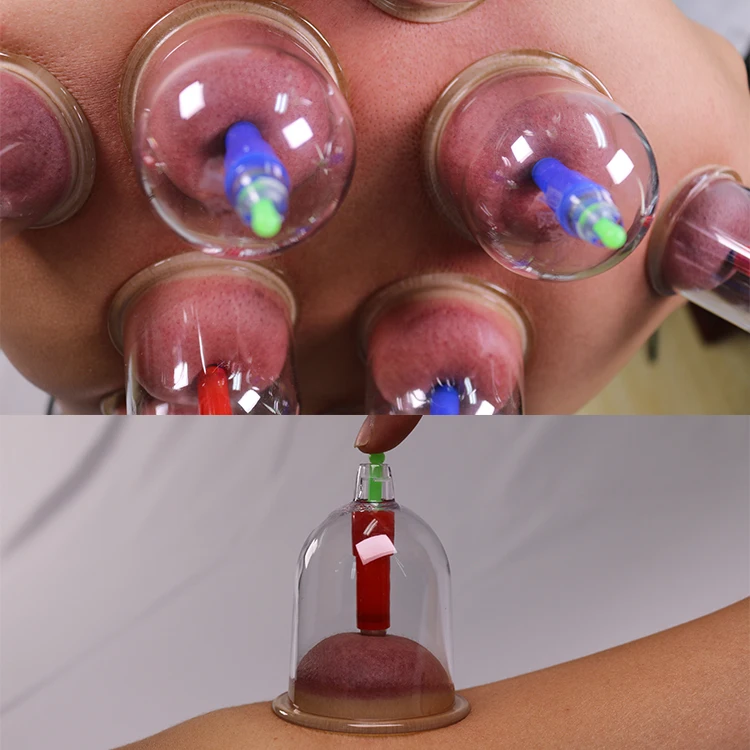 6pcs cupping 5.jpg