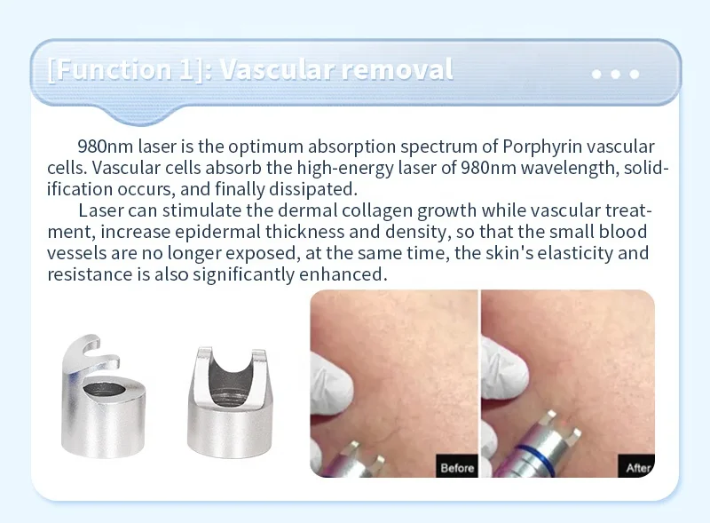 Professional 980nm Diode Laser 5-in-1 Multifunction System with Ice Compress Hammer