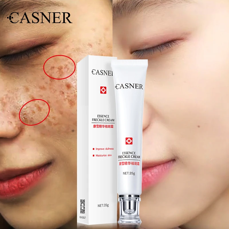 Casner Strong Whitening Freckle Removal Cream Melasma Remove Dark Spots  Melanin Melasma Remover Brighten Skin Anti-aging Cream - Buy Freckle