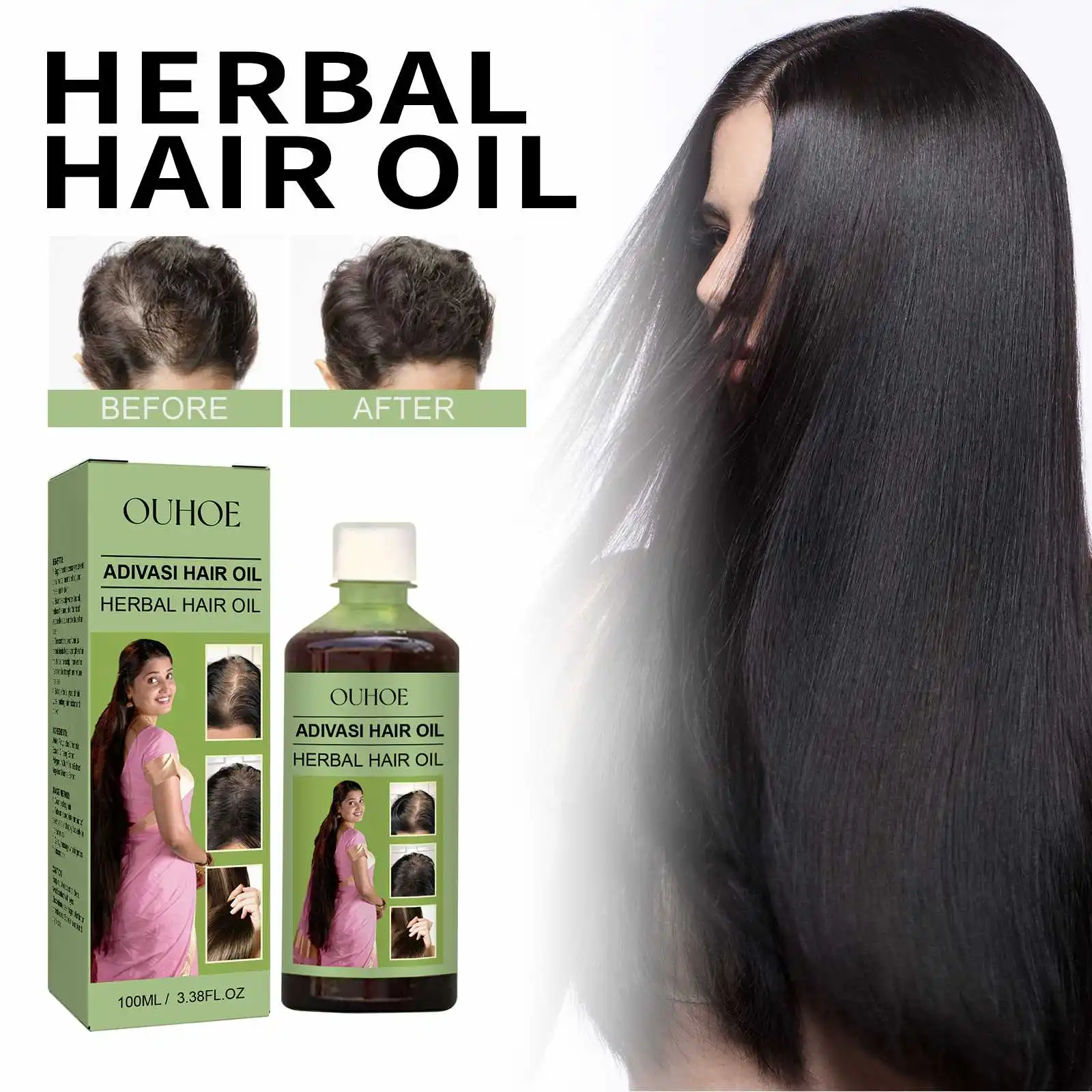 OUHOE Wholesale Private Label New Hot Sell Natural Vegan Hebal 100ML Hair Oil Hair Regrowth Anti Hair Loss Serum