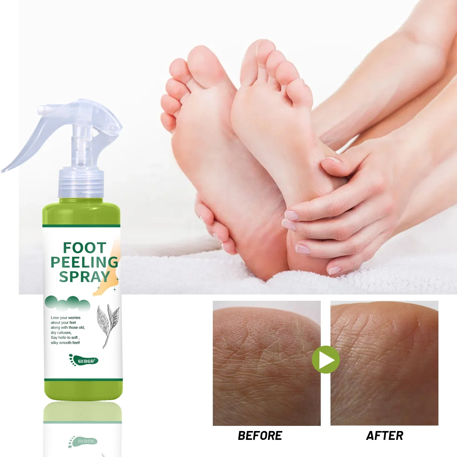 Get Rid Flaky Skin On Feet Remove Dead Skin Really Dry Feet Cure