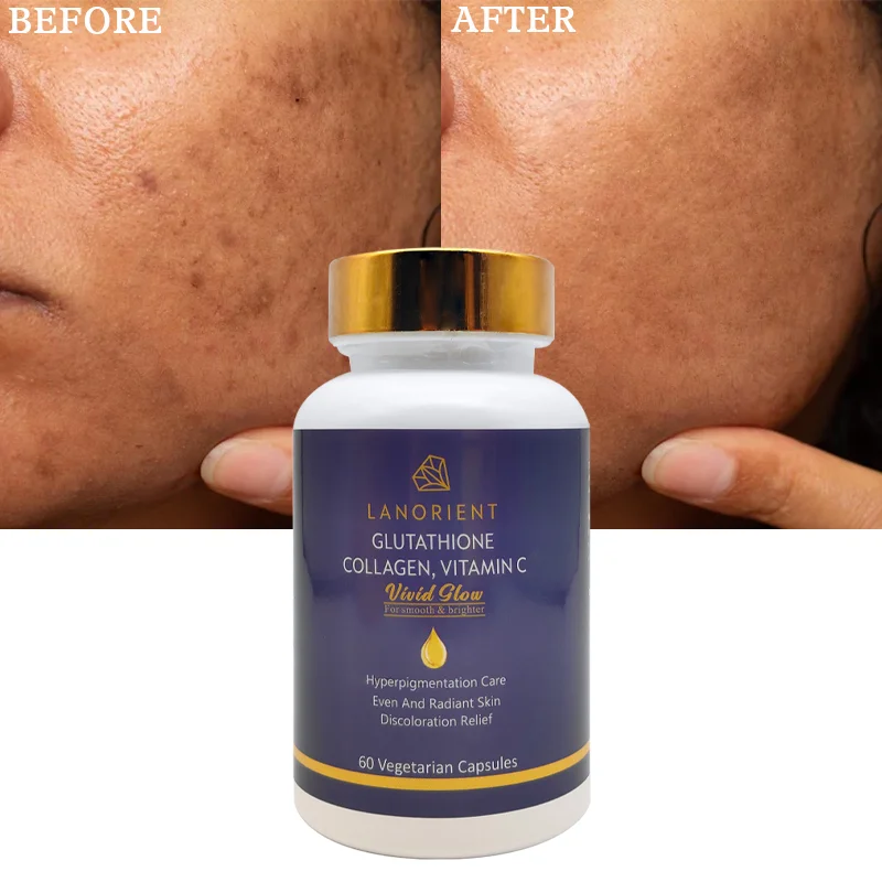 Private Label Organic Collagen Health Supplement Skin Whitening Remove Dark  Spot Glutathione Brightening Capsule