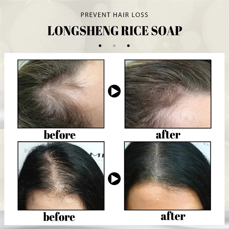 Moisturize Repair Hair/ Hair Growth /Prevent Lost/Anti-Dandruf  Bamboo Charcoal Polygonum  Hair Darkening  Shampoo Soap Bar