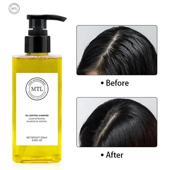 FANHUA HAIR CARE SUPPLIER WHOLESALE PRIVATE LABEL ORGANIC GENTLE CLEANSING 250ML HAIR OIL-CONTROL SHAMPOO FOR OILY SCALP