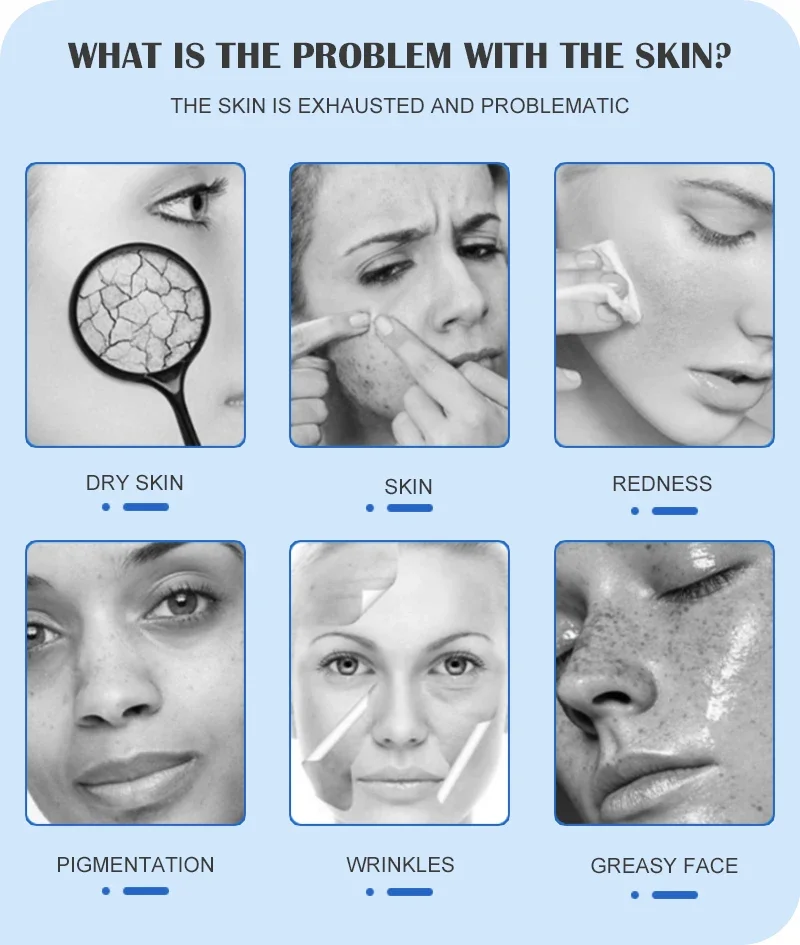 4 In 1 Oxygen Facial Skin Rejuvenation Hydra Pressure Skin