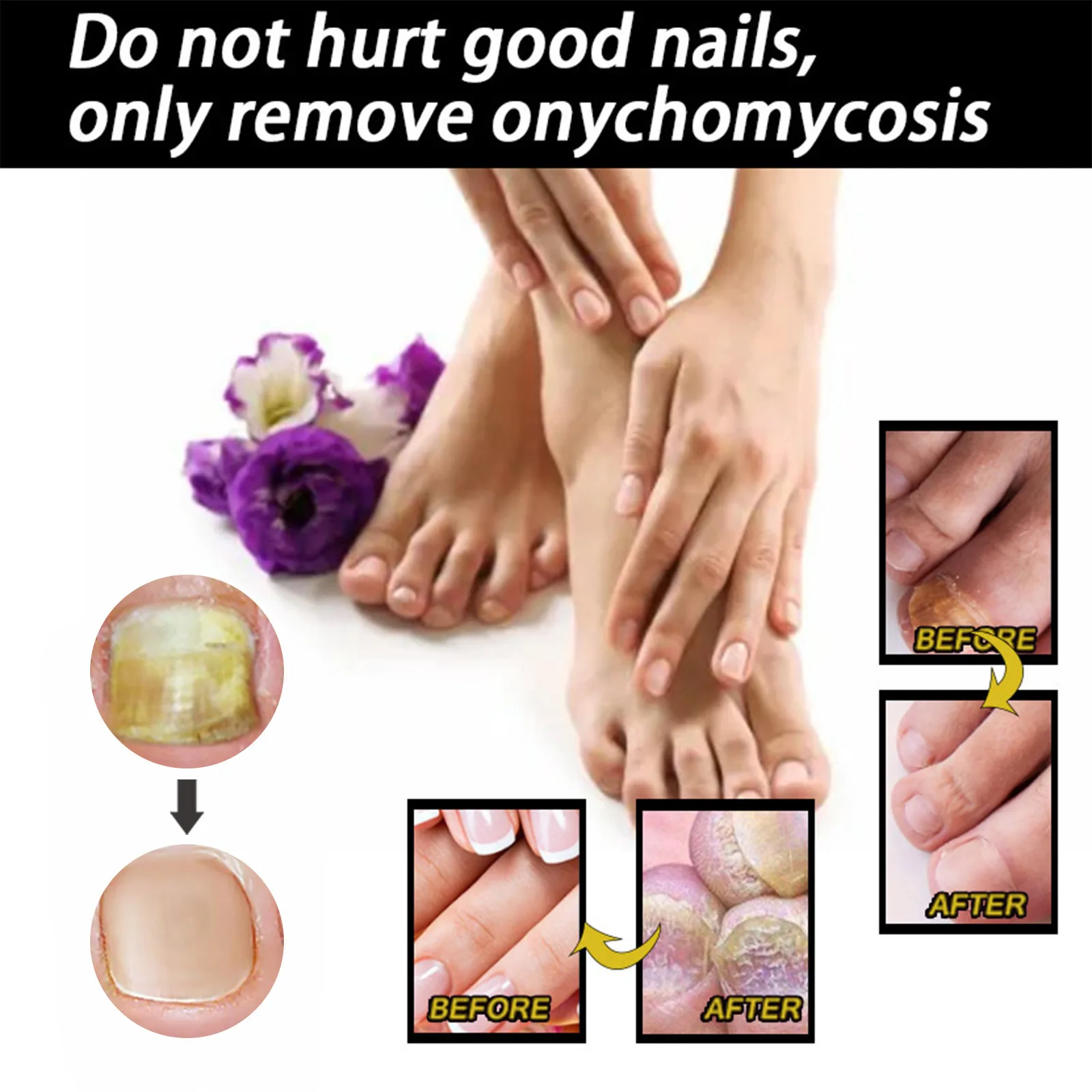 EELHOE Wholesale 30ML Nail Repair Liquid Thickening Brightening Repairing Serum Nail Fungal Nail Care Liquid