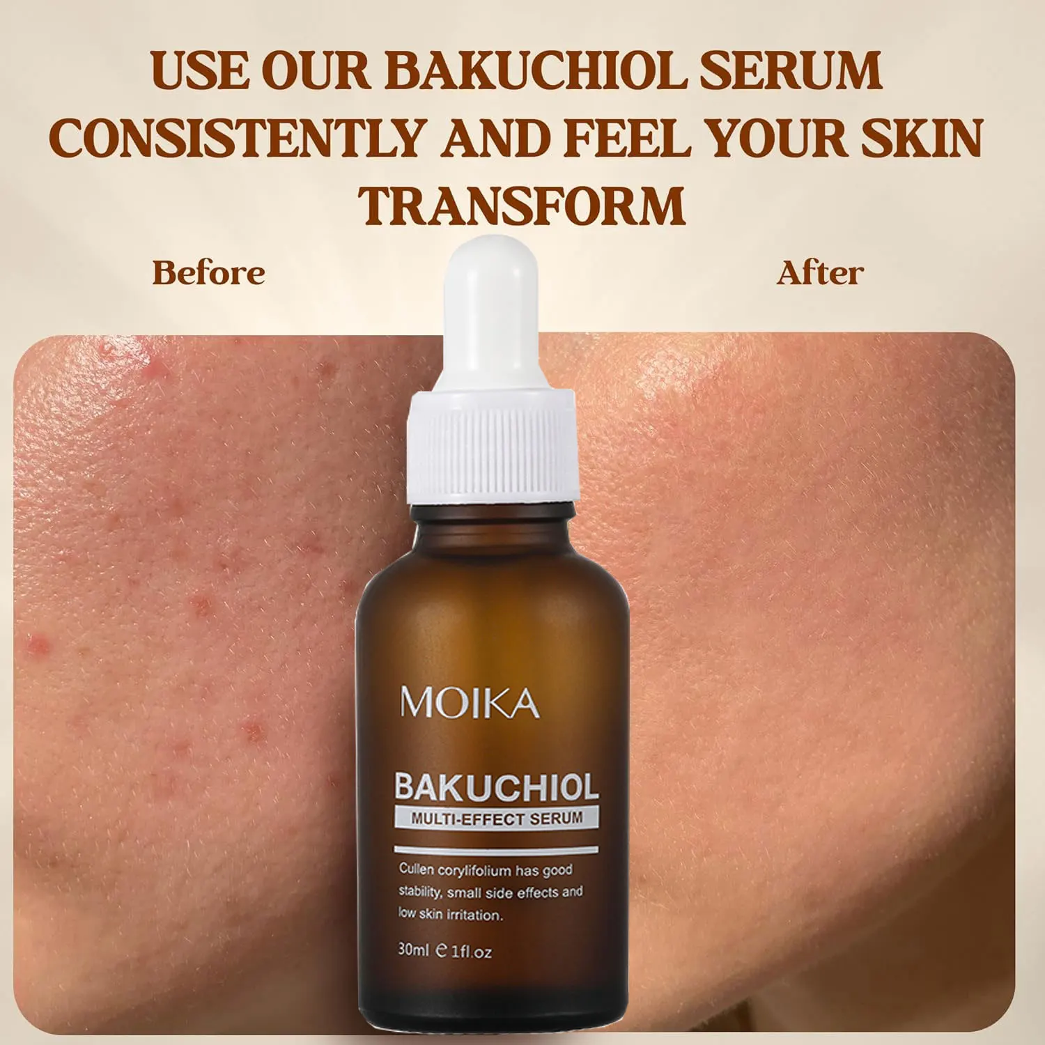 MOIKA Bakuchiol Anti-Aging Face Serum with Niacinamide | Organic