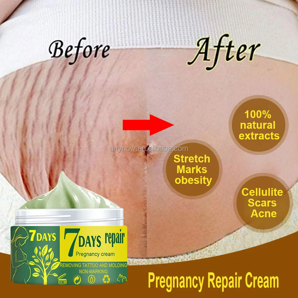  Stretch Marks Cream (5).jpg