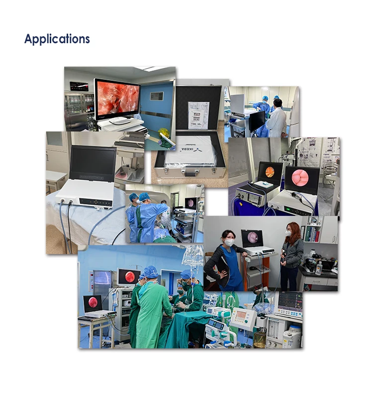Electric Power Source Medical ENT Endoscope Camera System Complete Laparoscopy Tower Laparoscopic Machine Endoscopy