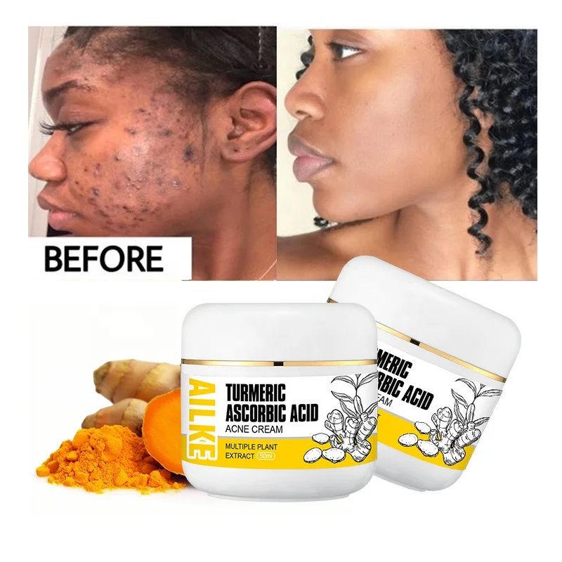 Ailke Tumeric Pimples Vitamin C Remove Moisturizing Cleansing Face Smoothing Night Acne Facial Cream for Glowing Skin