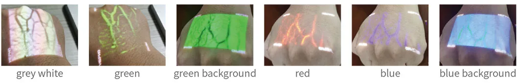 HF-410A Medical High Resolution Multiple Colors Display Handheld Portable Vein Finder Illuminator factory