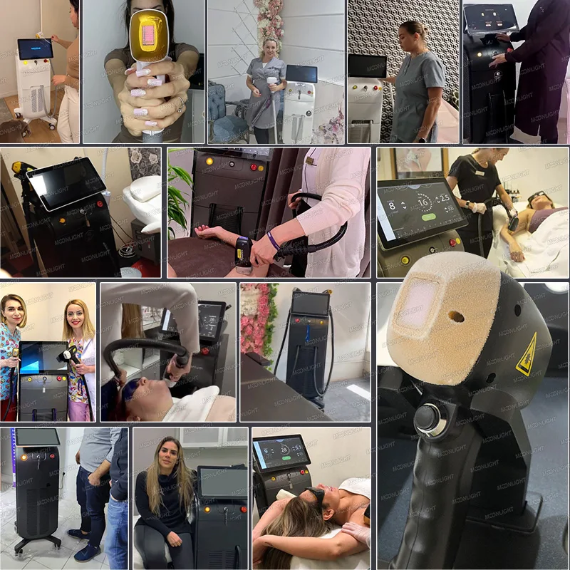 Smart Macro Channel Cooling Gel Fiber Optic Cables for Diode Laser Hair Removal Spark Pro Machine Beauty Equipment