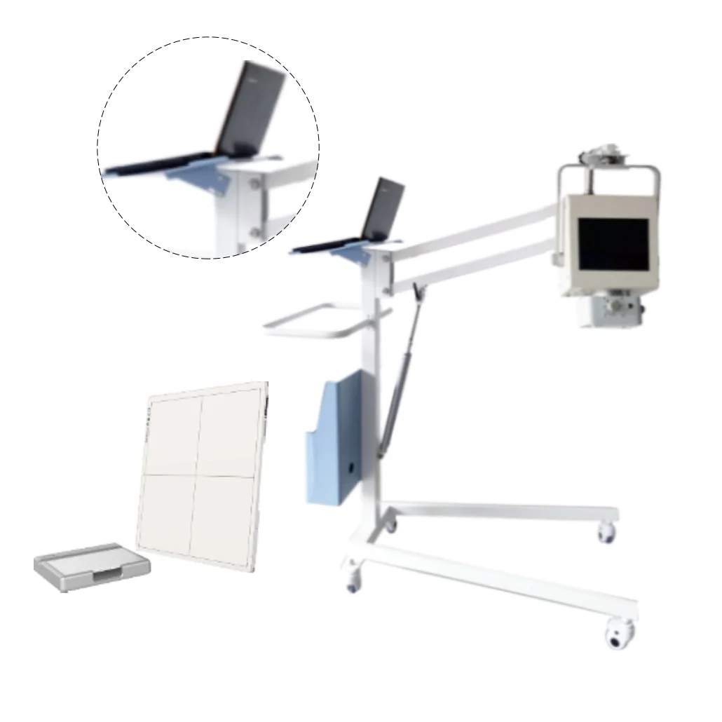 Professional Hospital Use Frequency HFX-05E Digital Portable X-ray System Machine details