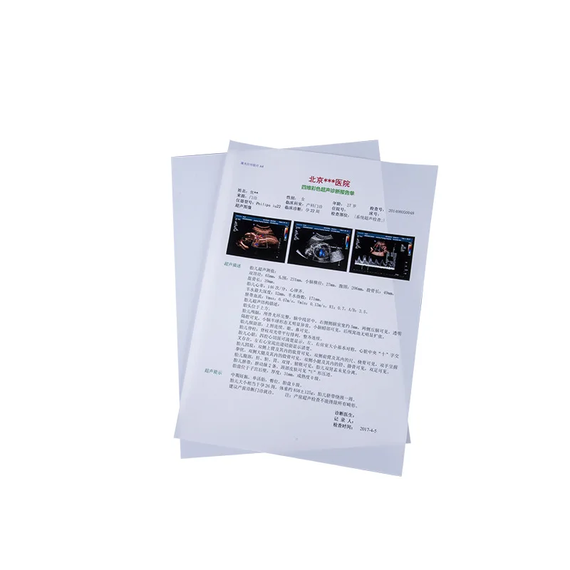 Inkjet Blue Medical Dry Film Transparent Blue Xray Film For CT DR MRI Radiological Device