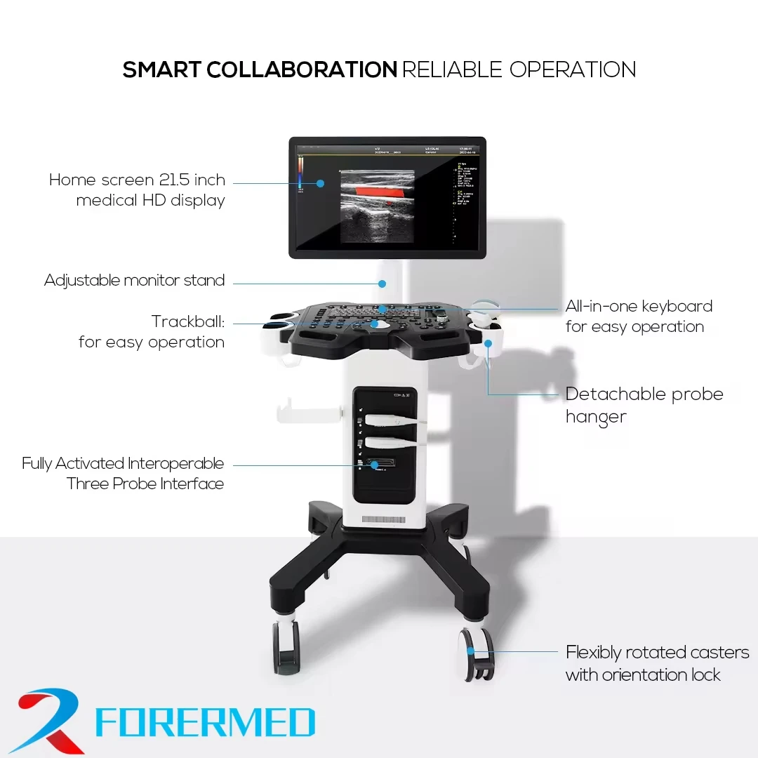 Color Digital Trolley Ultrasound Diagnosis System