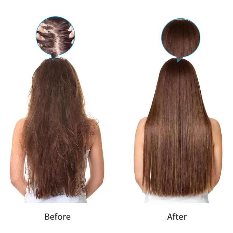 Laser Hair Comb Brush For Hair Regrowth 670nm Laser Hair Regrowth Emf