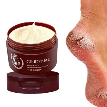 Anti Fungal Foot Repair Foot Cream Dead Skin Removal Peeling Moisturizing Exfoliation Foot Care Repair Cream For Cracked Heels