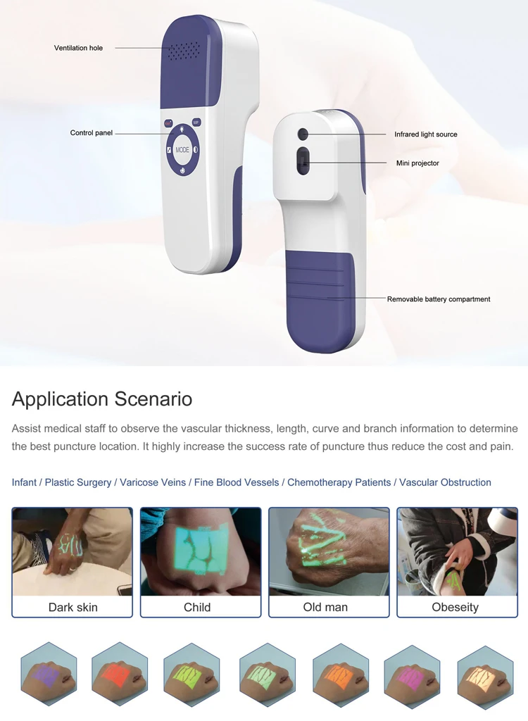 Medical Portable Vein Finder Infrared Accurate Visualization Improve Venipuncture Success Rate Medical Device