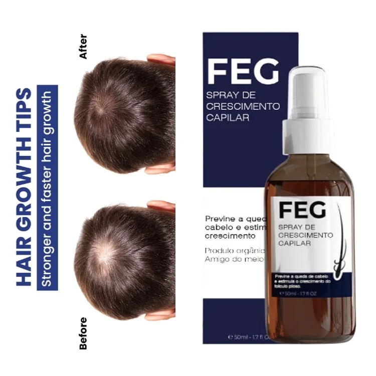 The Latest Inventions of China Ginseng Extract Polygonum YUDA Hair Growth Spray/ FEG Pilatory