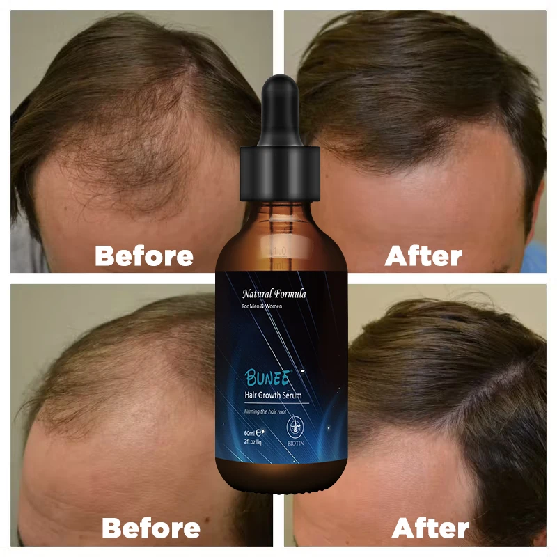 Super Fast Hair Growth Serum Tonic 5% Treatment Oil 60ml