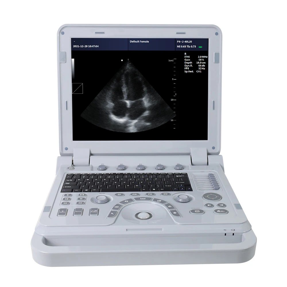 CONTEC CMS1700B Multiple 3D 4D Probe Digital Human Ultrasound Scan Ecocardiografo Color Doppler ultra Sound Machine