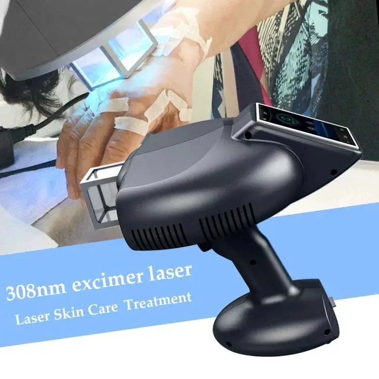Excimer Laser Vitiligo Machine - Mini Psoriasis Treatment