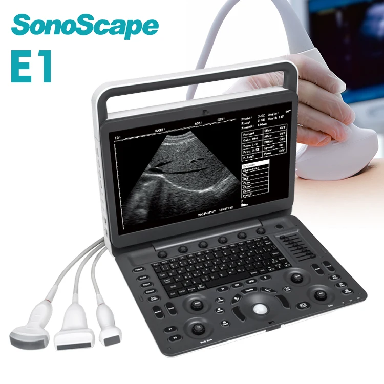 Sonoscape E1 E2 medical ultrasound instruments 4d ultrasound machine ultrasound-121054